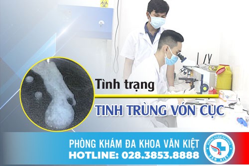 Tinh Trùng Vón Cục Là Gì ? Có Nguy Hiểm Không?