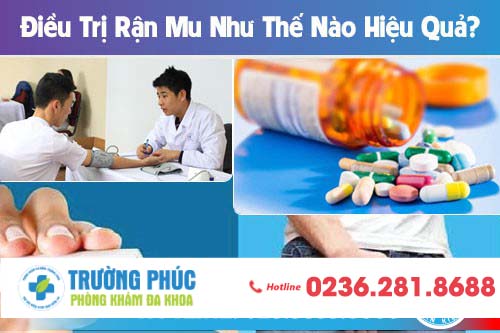 Điều Trị Rận Mu Như Thế Nào Hiệu Quả?