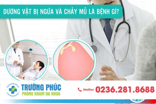 Dương vật bị ngứa và chảy mủ là bệnh gì?