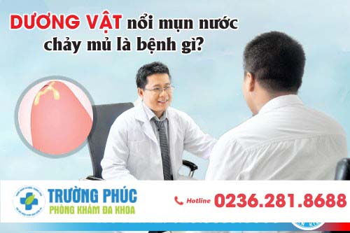 Dương vật nổi mụn nước chảy mủ là bệnh gì?