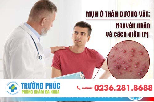 Mụn ở thân dương vật: Nguyên nhân và cách điều trị