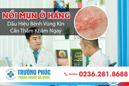 Nổi mụn ở háng là bệnh gì? Có nguy hiểm không?