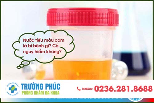 Nước tiểu màu cam là bị bệnh gì? Có nguy hiểm không?