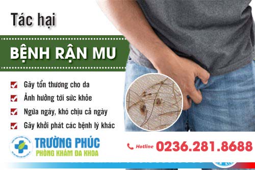 Bệnh rận mu ở nam giới có nguy hiểm không? Bệnh rận mu ở nam giới có nguy hiểm không?