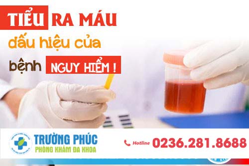 Đi tiểu ra máu - nguyên nhân và cách chữa trị hiệu quả