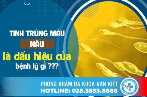 Tinh Trùng Màu Nâu Là Dấu Hiệu Của Bệnh Gì?