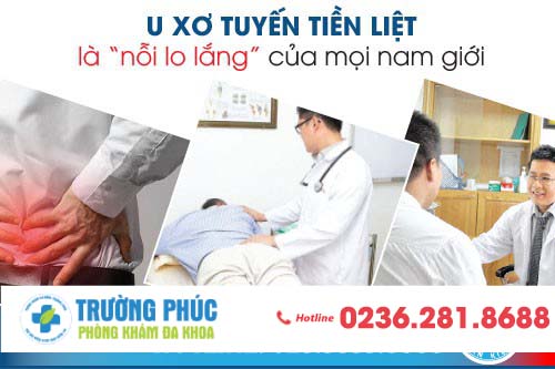 Cách Chữa Trị U Xơ Tuyến Tiền Liệt Ở Nam Giới