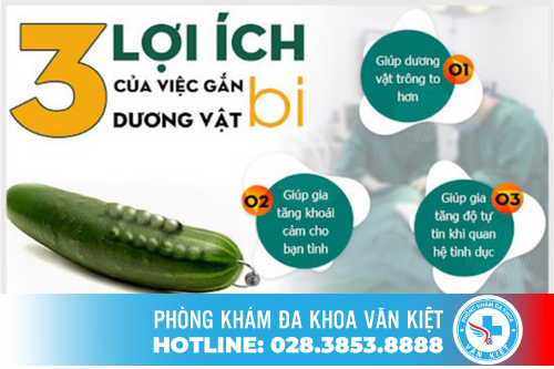  Cấy bi dương vật bằng phương pháp xâm lấn tối thiểu Hàn Quốc