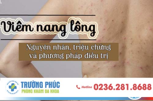 Viêm Nang Lông Vùng Kín Ở Nam Giới Và Phương Pháp Chữa Trị Dân Gian
