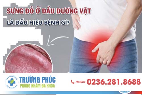 Sưng dương vật và các bệnh liên quan