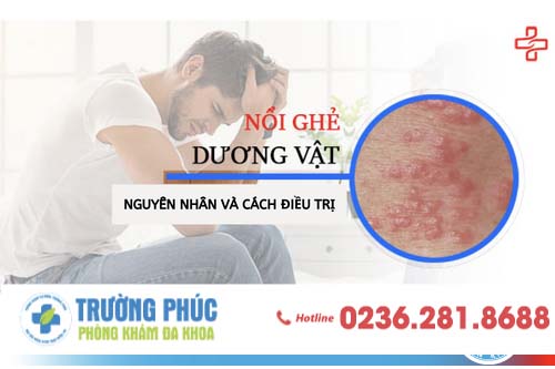 Nổi ghẻ ở dương vật là bệnh gì và cách điều trị