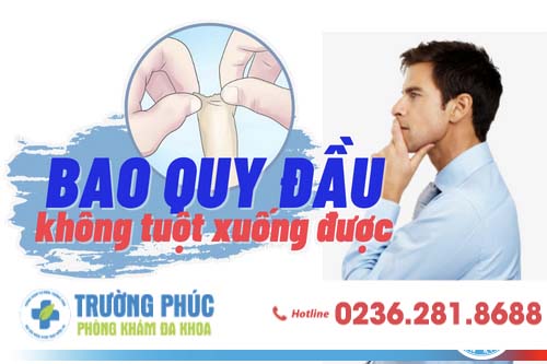 Bao quy đầu không tự tuột xuống được phải làm sao?