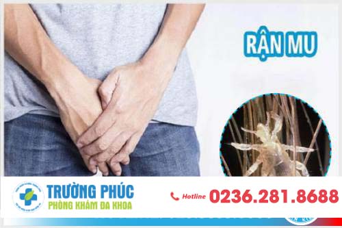 Bệnh Rận Mu Ở Nam Giới Và Những Điều Cần Biết