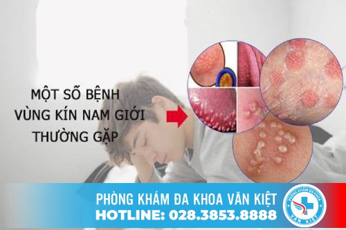 MỘT SỐ BỆNH LÝ Ở CƠ QUAN SINH DỤC NAM