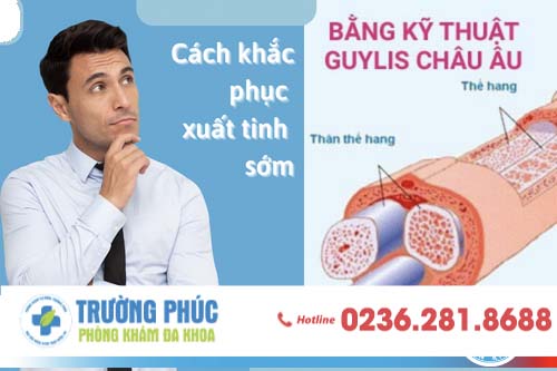 Phương pháp chữa xuất tinh sớm tại nhà cho nam giới