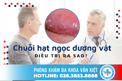 Bác sĩ Võ Minh Nguyễn chia sẻ cách hỗ trợ điều trị hạt ngọc dương vật hiệu quả