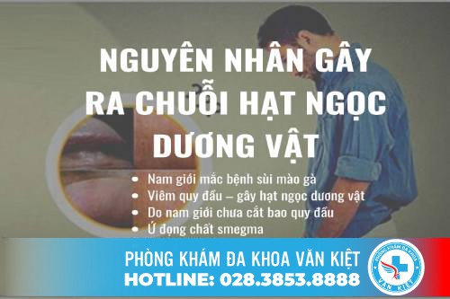 Chuỗi hạt ngọc dương vật có phải là bệnh?