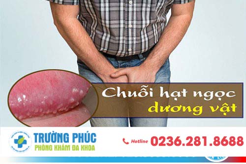 Thế nào là chuỗi hạt ngọc dương vật ?