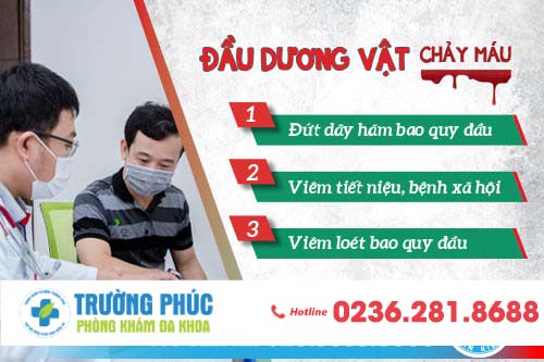 Chảy máu dương vật: Nguy cơ mắc bệnh nam khoa nguy hiểm