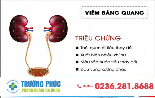 Dấu Hiệu Viêm Bàng Quang Là Gì?