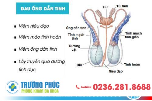 Đau ống dẫn tinh là bệnh gì?