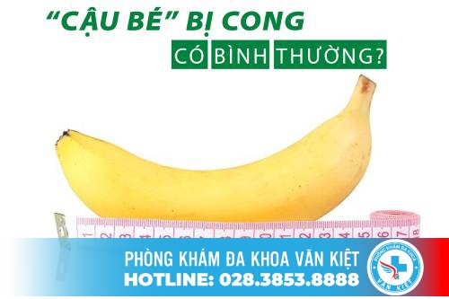 Nguyên Nhân Khiến Cho Dương Vật Bị Cong Là Gì?