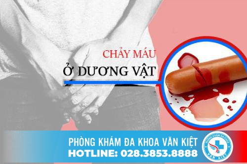 Dương vật chảy máu có nguy hiểm không? Nguyên nhân và cách hỗ trợ điều trị hiệu quả