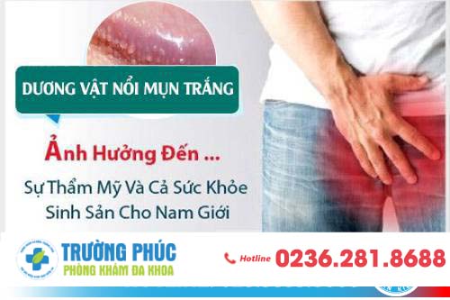 Nổi Đốm Trắng Ở Vùng Kín Nam Là Dấu Hiệu Của Bệnh Nào?