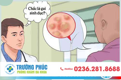 Gai sinh dục ở nam giới và những điều cần biết