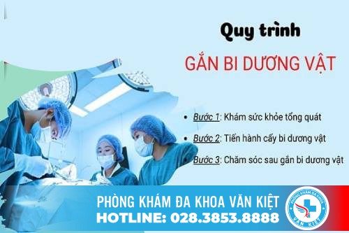 Có thể dùng nhiều chất liệu bi gắn vào để tăng kích thước 