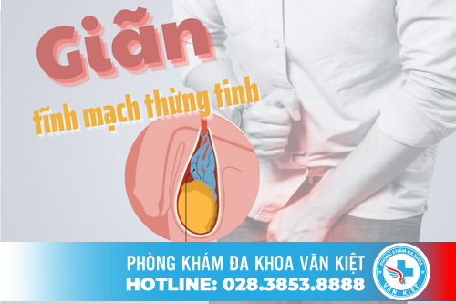 Giãn tĩnh mạch thừng tinh là gì?