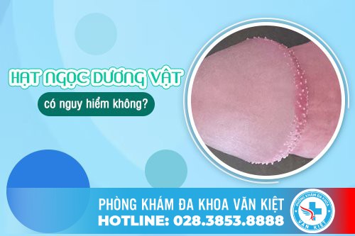 Hạt ngọc dương vật có nguy hiểm không? Cách điều trị hiệu quả