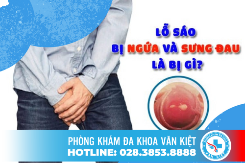 Lỗ Tiểu Đỏ Và Ngứa Là Dấu Hiệu Của Bệnh Gì?