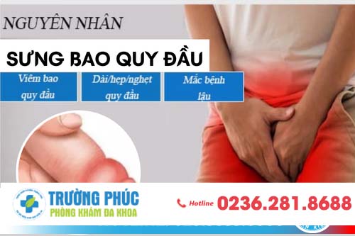 Sưng bao quy đầu là bệnh gì? Cách khắc phục nhanh và hiệu quả