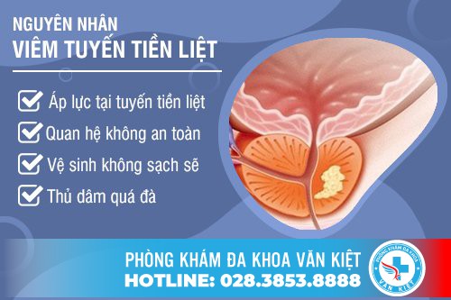 Những Đối Tượng Có Khả Năng Viêm Tuyến Tiền Liệt Cao