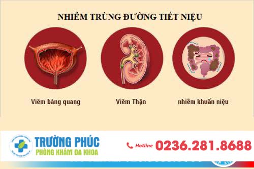 Các dấu hiệu bệnh nhiễm trùng đường tiểu