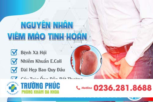 Cẩn thận với chứng viêm mào tinh hoàn và phương pháp điều trị hiệu quả