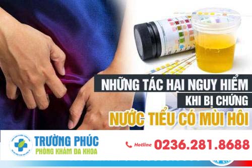 Đi tiểu có mùi tanh là bệnh gì?