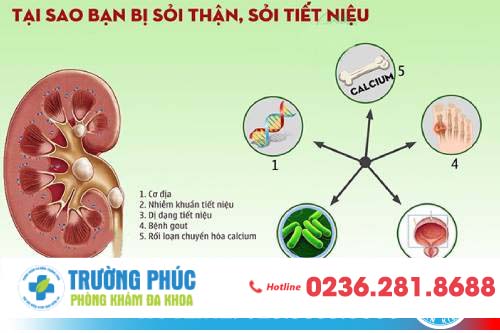 Sỏi tiết niệu là bệnh gì? Cách chữa sỏi tiết niệu