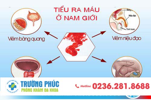 Đi vệ sinh tiểu ra máu là bệnh gì?