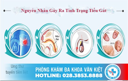 NGUYÊN NHÂN VÀ PHƯƠNG PHÁP ĐIỀU TRỊ TIỂU RẮT Ở NAM GIỚI