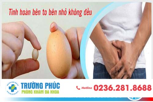 Tinh hoàn bên to bên nhỏ không đều có nguy hiểm không?