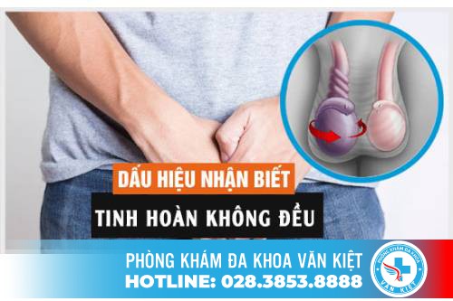 Tinh hoàn bị lệch thì có sao không?