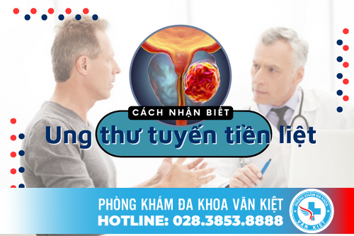 Ung Thư Tuyến Tiền Liệt Cách Nhận Biết Và Phòng Tránh
