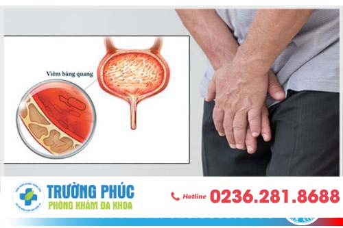 VIÊM BÀNG QUANG - BỆNH LÝ NGUY HIỂM, CHỚ NÊN XEM THƯỜNG