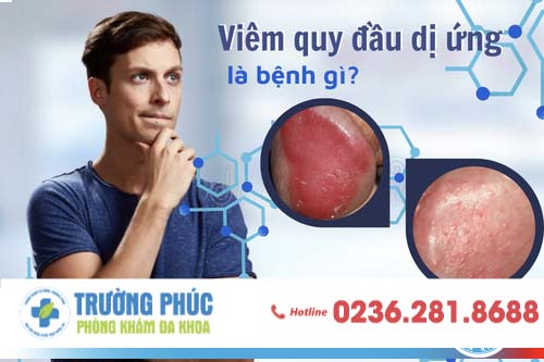 Viêm quy đầu có thể do nhiều nguyên nhân gây nên