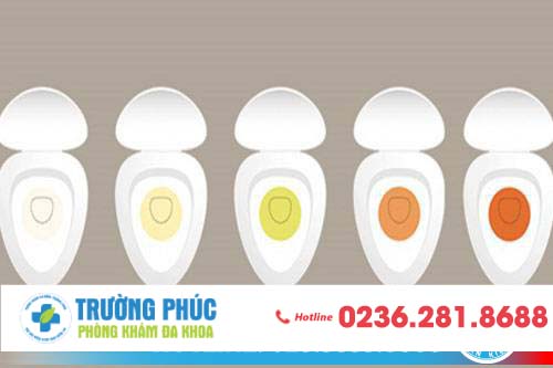 Viêm tuyến tiền liệt là bệnh gì và có gây ảnh hưởng gì không? Viêm tuyến tiền liệt là bệnh gì và có gây ảnh hưởng gì không?
